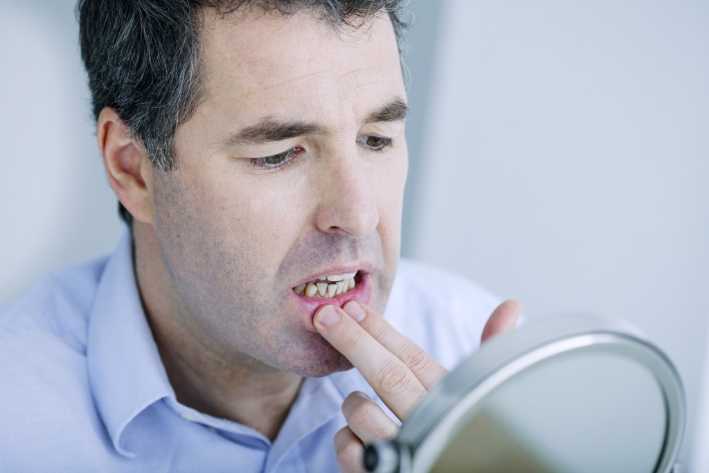 Concerned middle-aged man holding back lower lip to examine his own gums with a hand mirror. Gum disease, gingivitis, bleeding gums, sore gums, dental cleanings, dental hygiene, oral health.